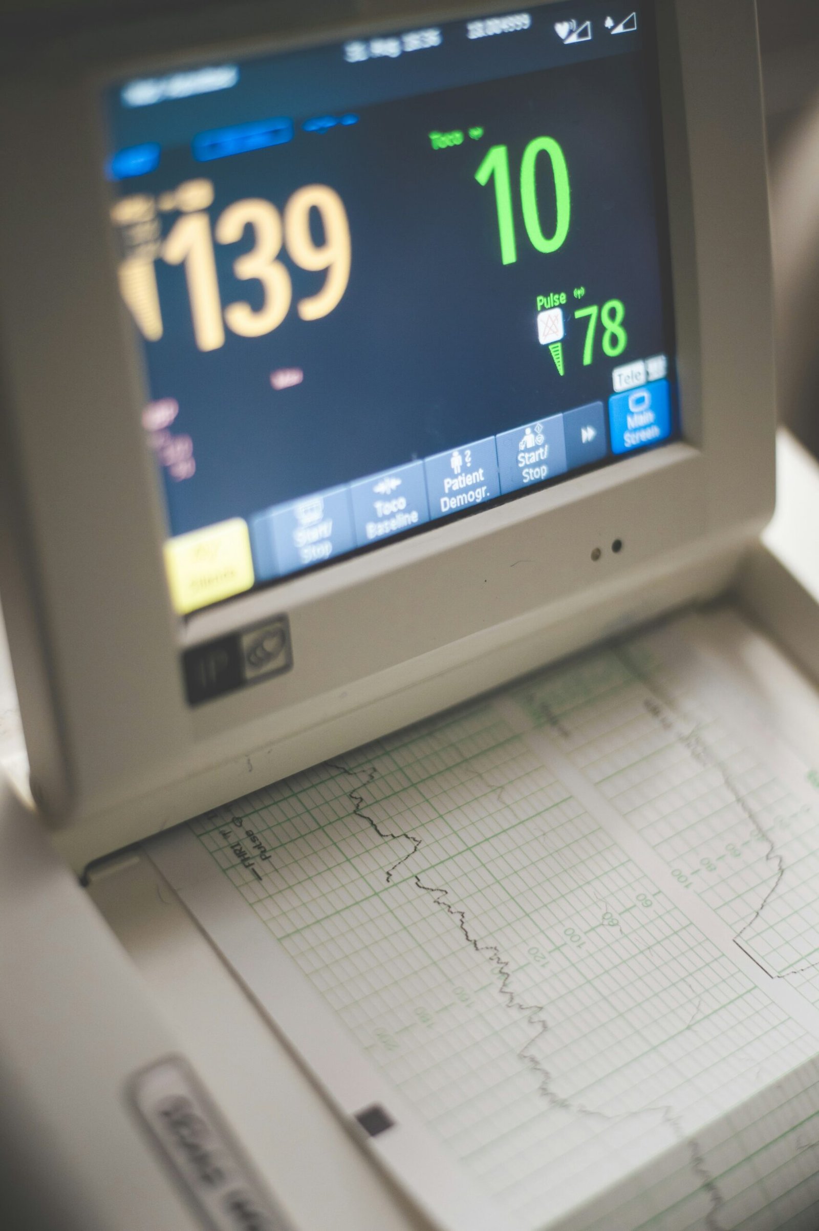 Patient monitor displaying vitals alongside a printed data strip